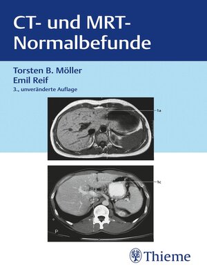 cover image of CT und MRT Normalbefunde